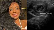 Lumena Aleluia conta que perdeu bebê - Foto: Reprodução / Instagram