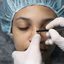 Rinoplastia está entre as cirurgias plásticas mais populares do Brasil