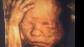 Max Porto mostra foto do ultrassom de sua primogênita, Luna - Twitter Reprodução