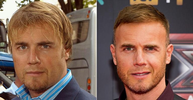 Gary Barlow: antes e depois - Getty Images