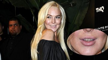 Lindsay Lohan surge com dentes sujos e amarelados - Getty Images