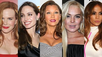 Veja os famosos de Hollywood que aplicaram botox - Getty Images