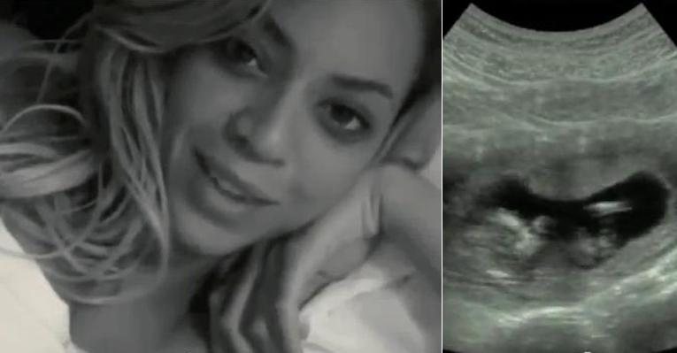 Beyoncé mostra primeira ultrassom de Blue Ivy no documentário 'Life Is But a Dream' - Reprodução/Youtube