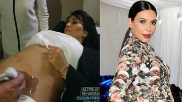 Kim Kardashian quer comer a placenta da filha. Mas a prática não oferece nenhum benefício à saúde - Foto-montagem