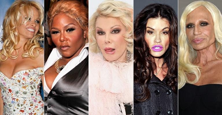 12 transformações marcantes dos famosos após cirurgia plástica - Getty Images