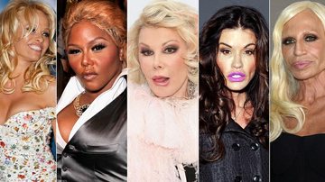 12 transformações marcantes dos famosos após cirurgia plástica - Getty Images