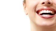 Café, vinho e chocolate podem acabar com os dentes brancos - Shutterstock