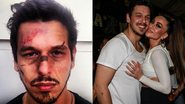 João Vicente, namorado de Sabrina Sato, grava esquete do Porta dos Fundos com rosto machucado- - Reprodução/Instagram e Cláudio Augusto/ Foto Rio News