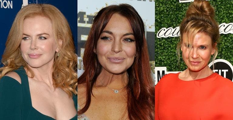 Veja como eram as celebridades antes do botox! - Getty Images