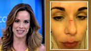 Ana Furtado revela ter sofrido acidente doméstico - TV Globo/Reprodução