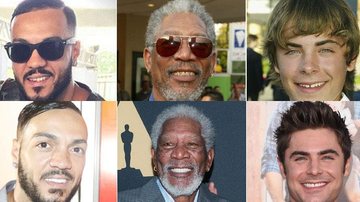 veja os famosos que mudaram completamente os dentes - Getty Images