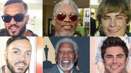 veja os famosos que mudaram completamente os dentes - Getty Images