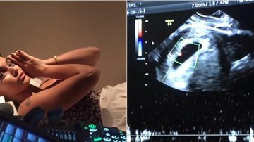 Kelly Key faz ultrassonografia - Reprodução Youtube