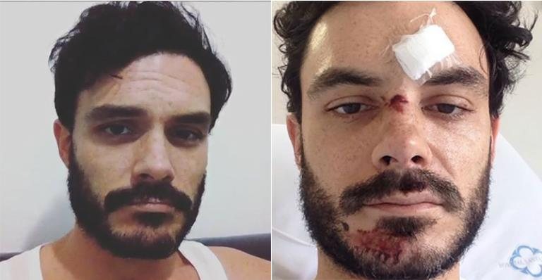 Kiko Pissolato sofre acidente: 'Poderia ter morrido' - Reprodução Instagram