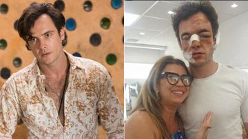 Gael fica irreconhecível após surra e maquiadora vibra - Divulgação/TV Globo/Reprodução/Instagram