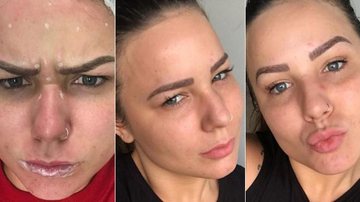 Cacau mostra resultados de preenchimento labial, botox e peeling aos 21 anos - Instagram/Reprodução