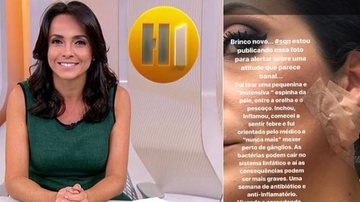 Apresentadora Izabella Camargo mexe em espinha e sofre séria inflamação na pele - TV Globo e Instagram/Reprodução