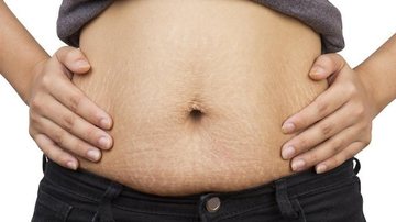 Conheça o novo tratamento que combate a flacidez e gordura - Shutterstock