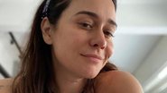 Alessandra Negrini posa com pet e encanta web: ''Eu amo'' - Reprodução/Instagram