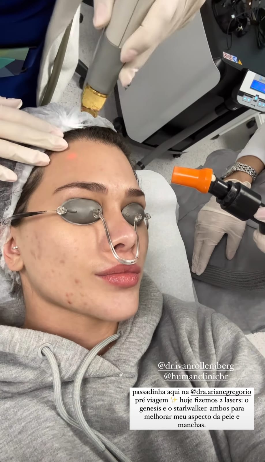 Flávia Pavanelli mostra procedimento para a pele nas redes sociais - Instagram