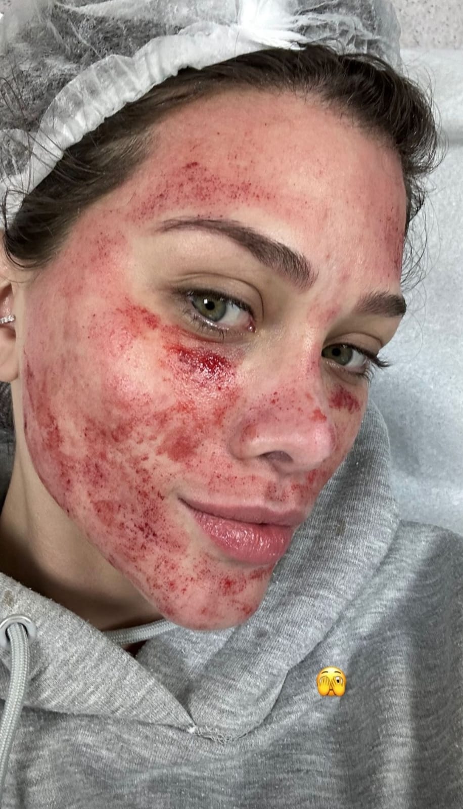Flávia Pavanelli assusta ou aparecer com rosto sangrando - Instagram
