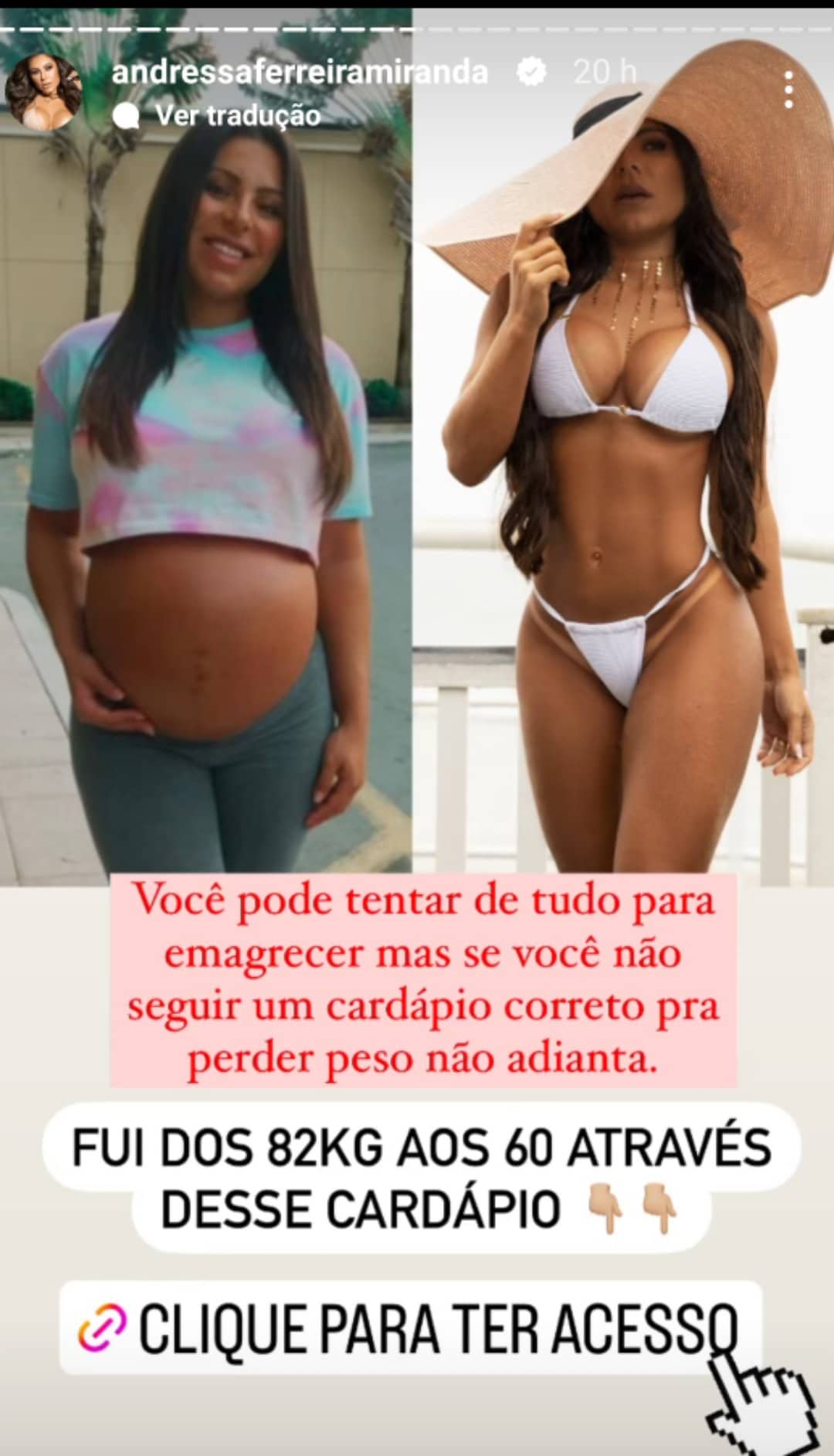 Andressa Ferreira antes e depois