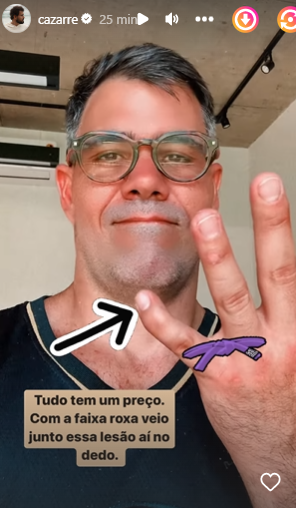 Juliano Cazarré mostra lesão no dedo