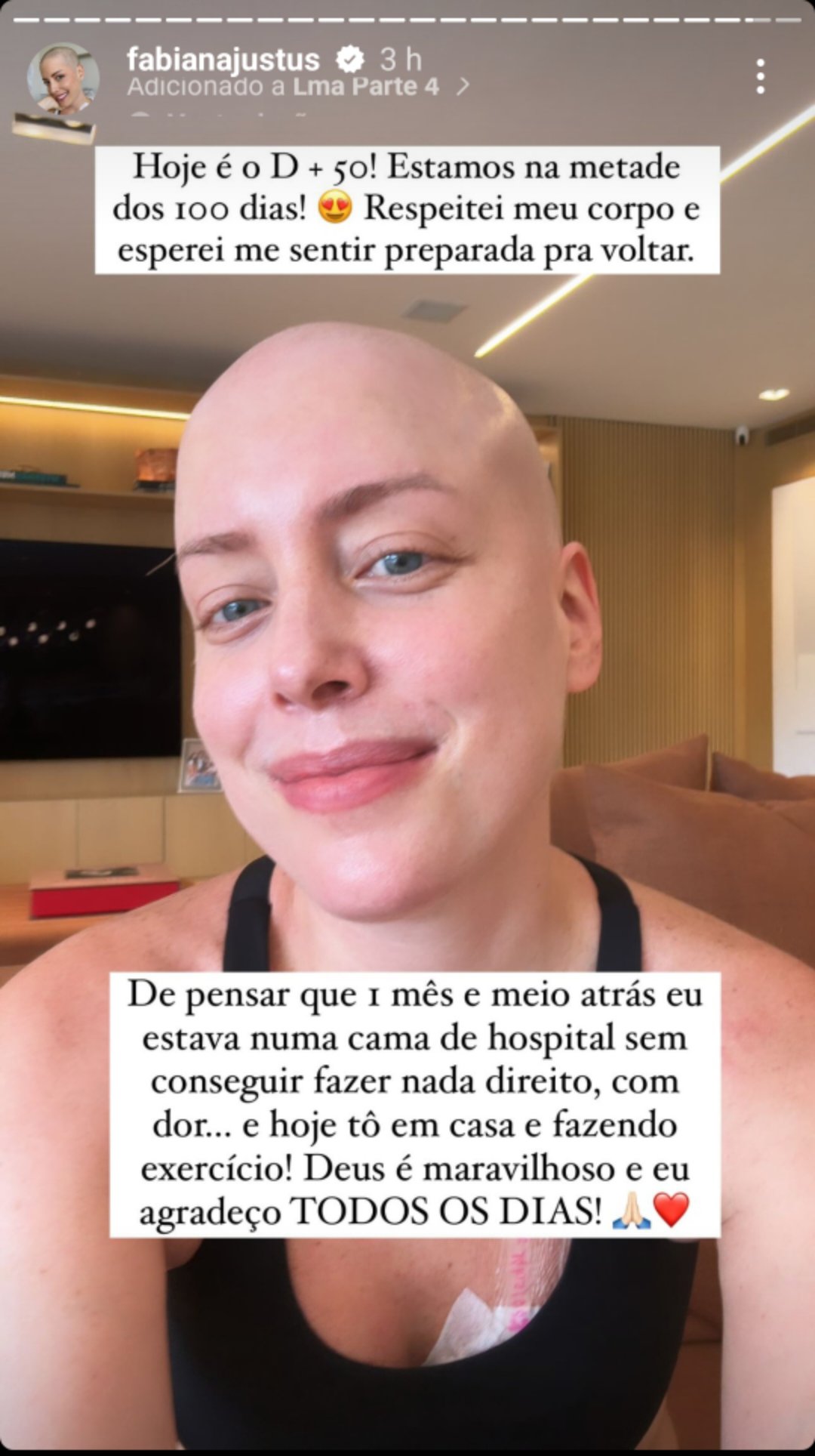 Fabiana Justus revela mudança após transplante