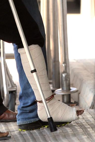 Halle Berry quebrou a perna direita em sua folga das filmagens de Cloud Atlas