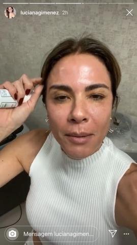 Luciana Gimenez exibe rosto sem maquiagem durante tratamento estético
